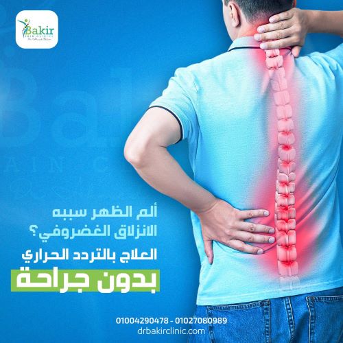 طرق علاج الانزلاق الغضروفي